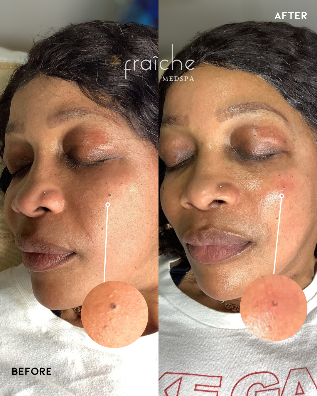 Combined before-and-after client photo pair 1