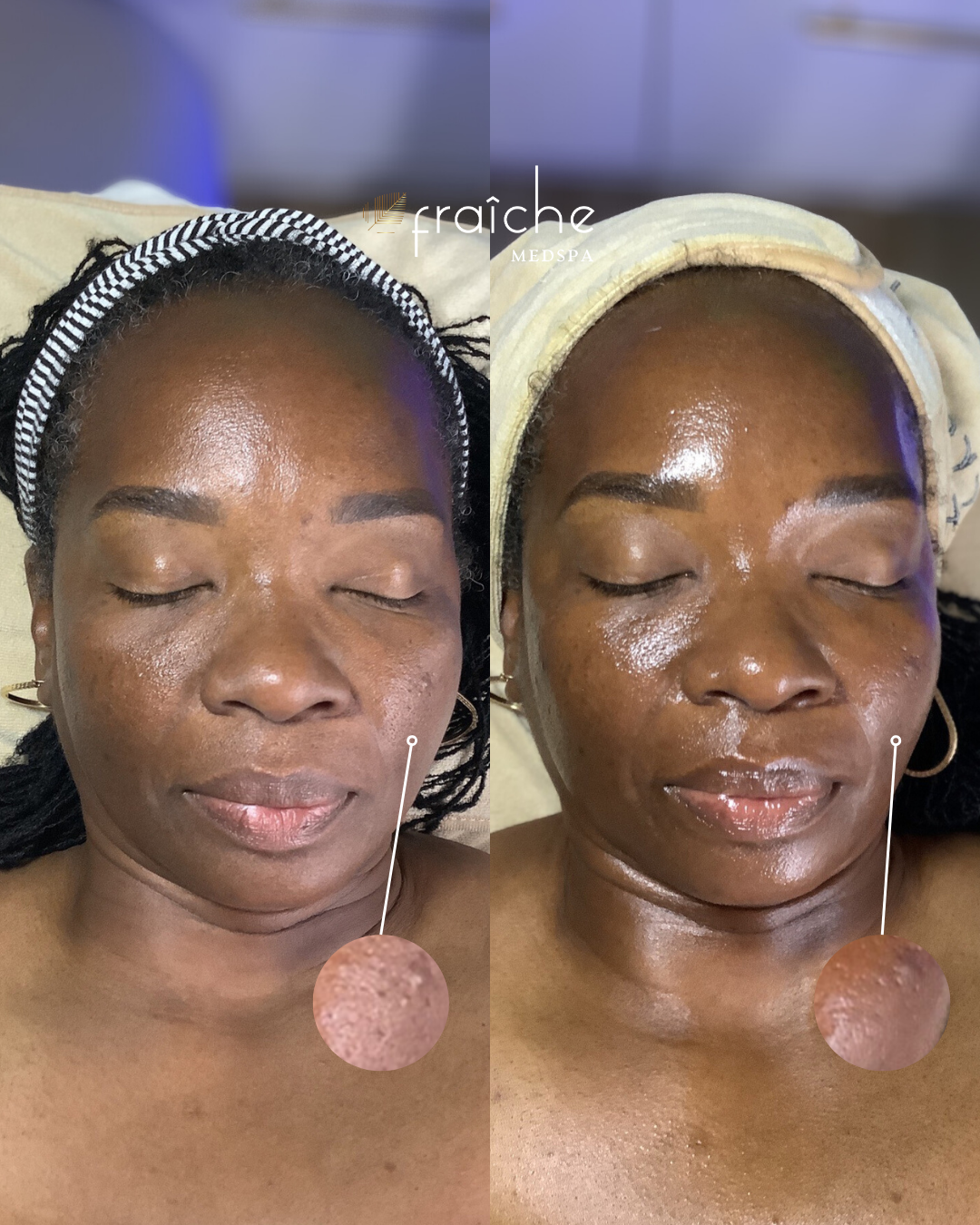 Combined before-and-after client photo pair 2