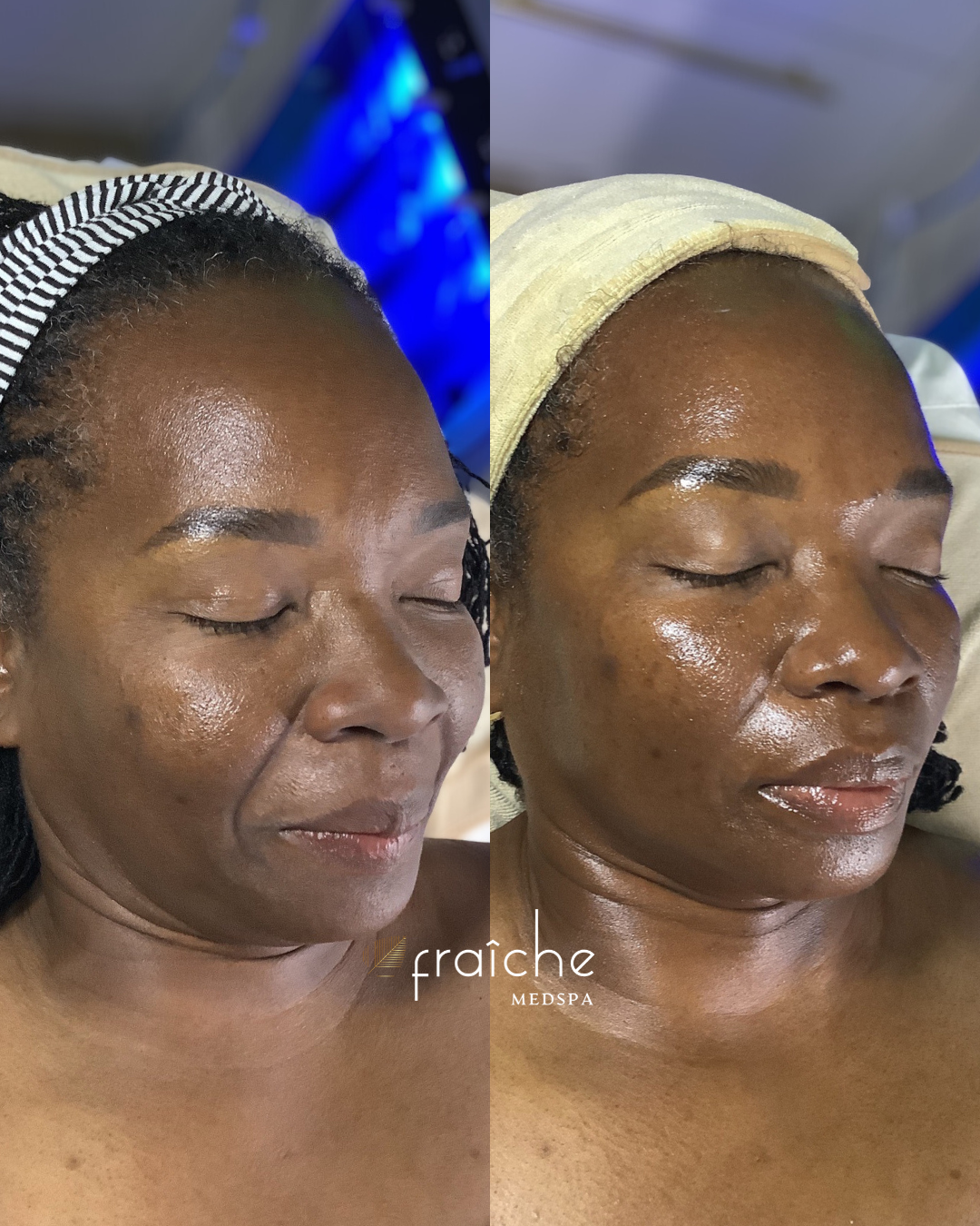 Combined before-and-after client photo pair 3