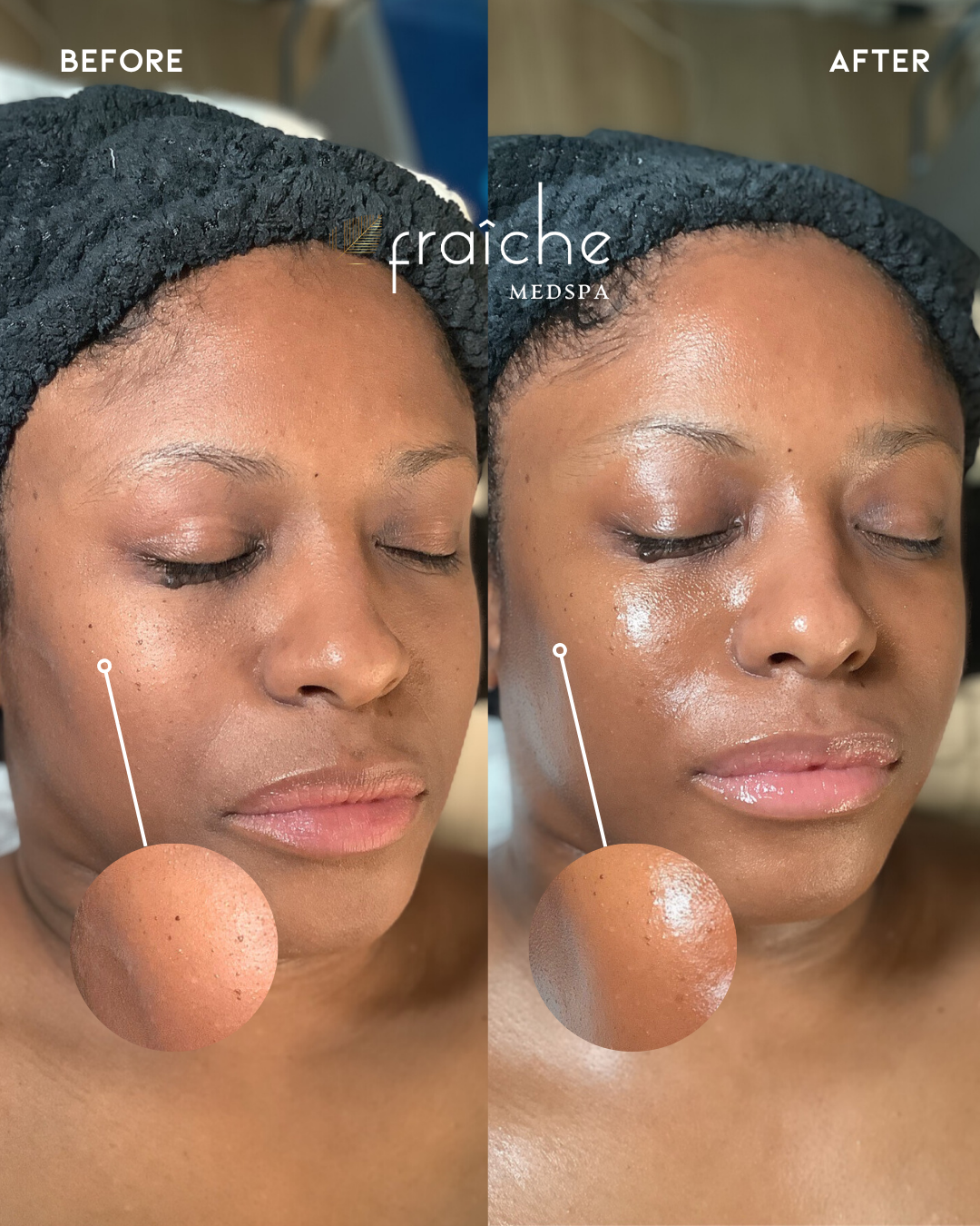 Combined before-and-after client photo pair 4