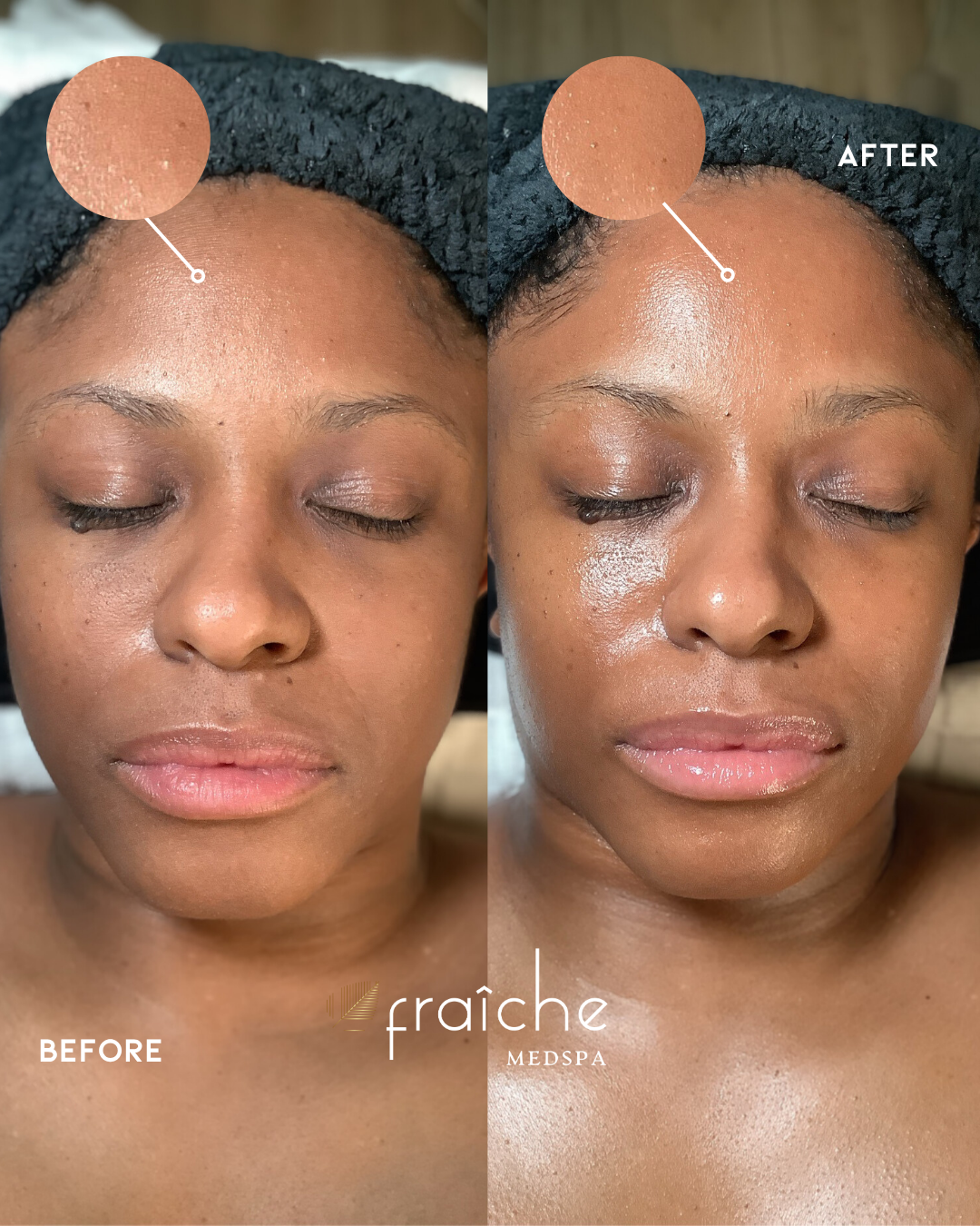 Combined before-and-after client photo pair 5