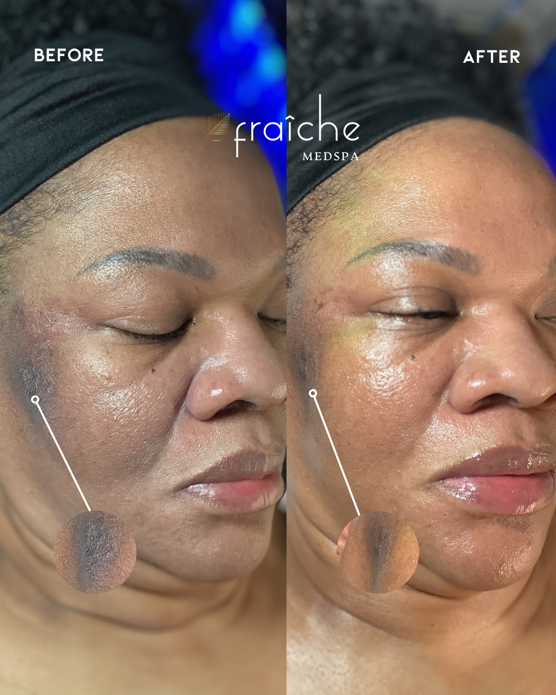 Combined before-and-after client photo pair 6