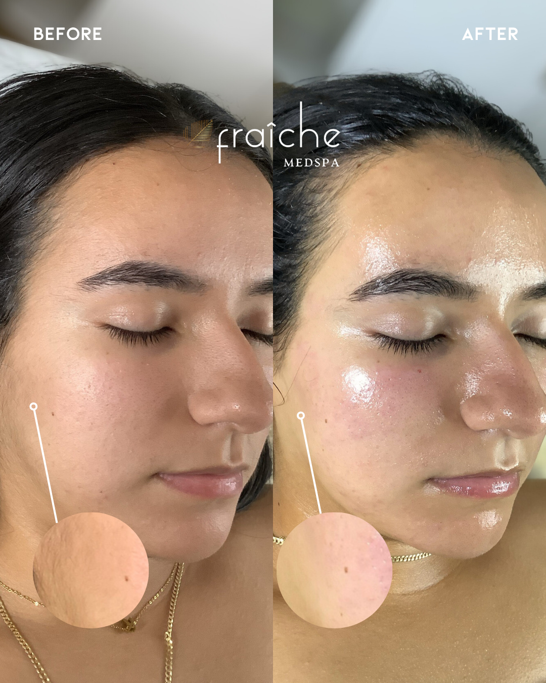Combined before-and-after client photo pair 7