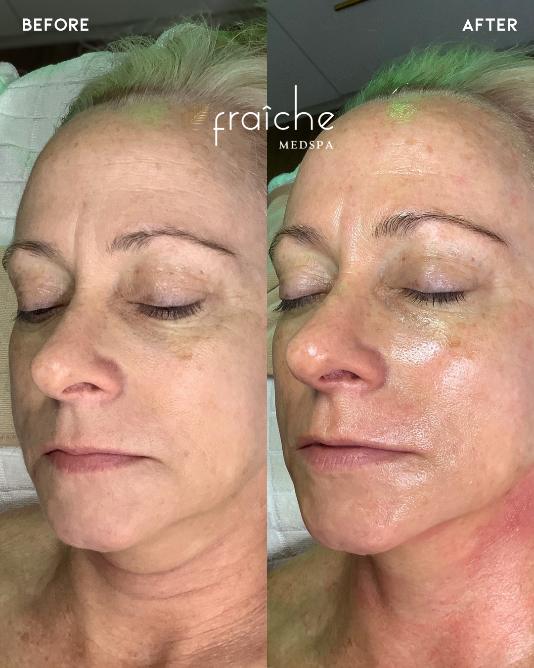 Combined before-and-after client photo pair 8