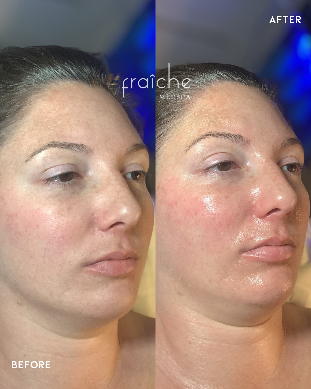 Combined before-and-after client photo pair 9