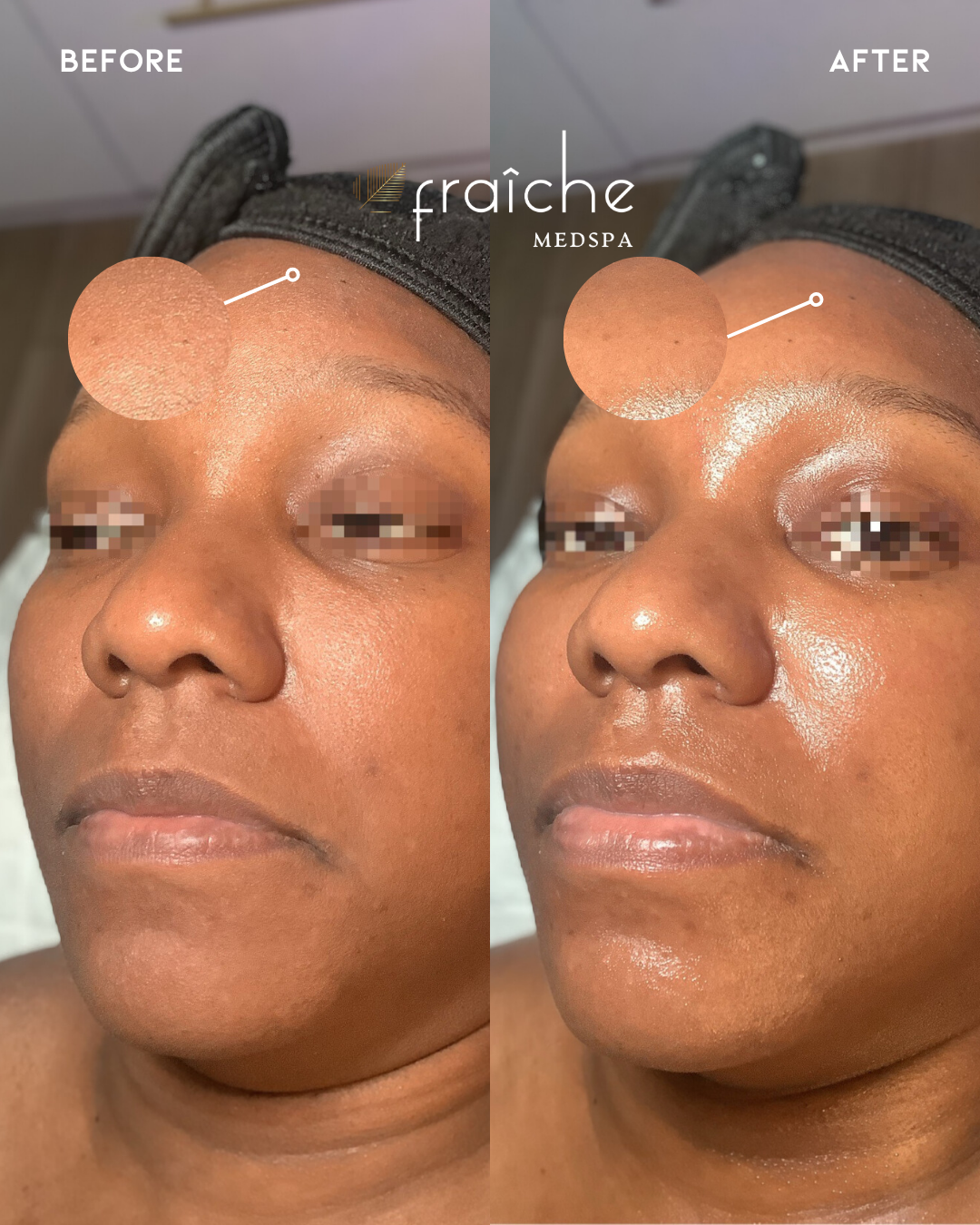Combined before-and-after client photo pair 10