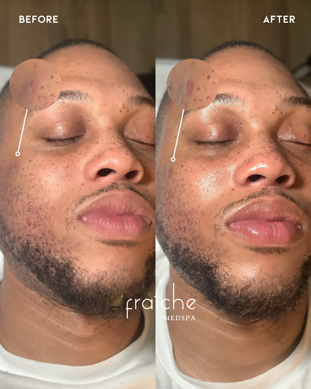 Combined before-and-after client photo pair 11